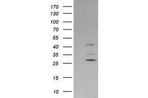 Western Blotting (WB) image for anti-Plasminogen Activator Inhibitor 2 (SERPINB2) antibody (ABIN1500885) (SERPINB2 anticorps)