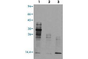 Western blot analysis of Lane 1: mouse brain tissue lysates, Lane 2: Hela cell lysates, Lane 3: TSA treated Hela cell lysates reacted with Acetyl lysine monoclonal antibody  at 1:1000-1:2000 dilution. (Acetylated Lysine anticorps  (acetylated))