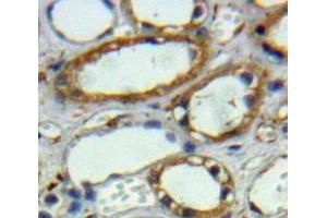 Used in DAB staining on fromalin fixed paraffin-embedded Kidney tissue (CA12 anticorps  (AA 25-302))