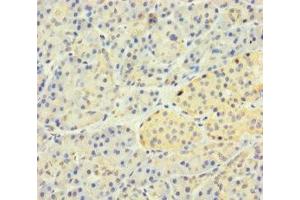 Immunohistochemistry of paraffin-embedded human pancreatic tissue using ABIN7170187 at dilution of 1:100 (SLC25A35 anticorps  (AA 120-168))
