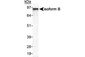 Western blot analysis of EPB41L3 in HeLa whole cell lysate using EPB41L3 polyclonal antibody . (EPB41L3 anticorps  (AA 400-500))