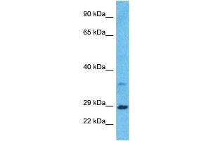 Host:  Rabbit  Target Name:  BDNF  Sample Type:  ACHN Whole Cell lysates  Antibody Dilution:  1ug/ml (BDNF anticorps  (Middle Region))