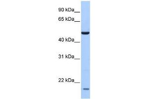 Human Lung; WB Suggested Anti-ZNF764 Antibody Titration: 0. (ZNF764 anticorps)