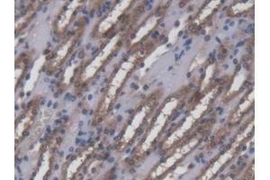 DAB staining on IHC-P; Samples: Mouse Kidney Tissue (Ninein anticorps  (AA 1-153))