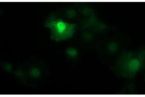 Image no. 2 for anti-Catenin (Cadherin-Associated Protein), beta 1, 88kDa (CTNNB1) antibody (ABIN1496898) (CTNNB1 anticorps)