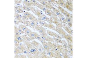 Immunohistochemistry of paraffin-embedded human liver using UCHL3 antibody. (UCHL3 anticorps  (AA 1-220))