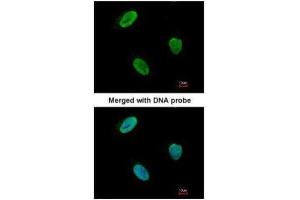 ICC/IF Image Immunofluorescence analysis of paraformaldehyde-fixed HeLa, using Rad9 , antibody at 1:100 dilution.