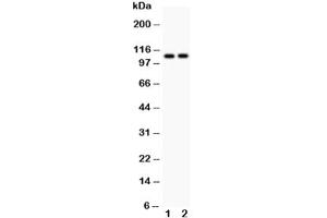 Western blot testing of ATP2A1 antibody and Lane 1:  rat skeletal muscle