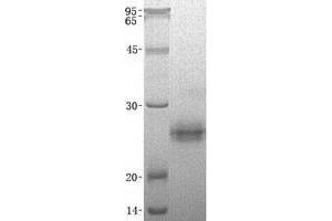 Validation with Western Blot (Kallikrein 6 Protein (KLK6) (Transcript Variant B) (His tag))