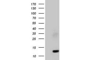 Western Blotting (WB) image for anti-Follicle Stimulating Hormone, beta Polypeptide (FSHB) antibody (ABIN1498318) (FSHB anticorps)