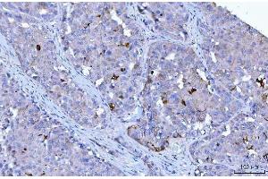 IHC analysis of HGS using anti-HGS antibody (ABIN7601207).