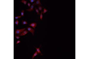 ABIN6274061 staining NCI-H1299 cells by ICC/IF.
