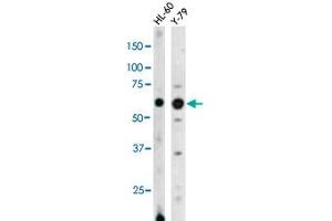 The RAD9A (phospho S328) polyclonal antibody  is used in Western blot to detect Phospho-RAD9A-S328 in HL-60 (left) and Y-79 (right) cell lysates (RAD9A anticorps  (pSer328))