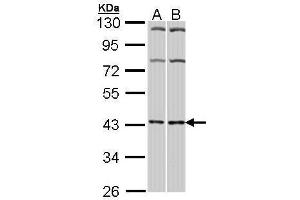 WB Image Sample (30 ug of whole cell lysate) A: Hela B: Molt-4 , 10% SDS PAGE antibody diluted at 1:1000