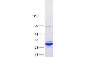 Validation with Western Blot