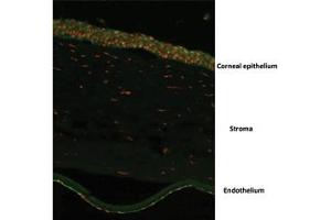 WB Suggested Anti-GCLM Antibody    Titration: 2.
