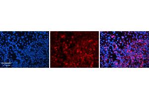 Rabbit Anti-MYC Antibody Catalog Number: ARP30292_P050 Formalin Fixed Paraffin Embedded Tissue: Human Lymph Node Tissue Observed Staining: Nucleus Primary Antibody Concentration: 1:100 Other Working Concentrations: N/A Secondary Antibody: Donkey anti-Rabbit-Cy3 Secondary Antibody Concentration: 1:200 Magnification: 20X Exposure Time: 0.
