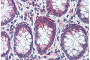 Human Colon (formalin-fixed, paraffin-embedded) stained with GATA6 antibody ABIN462170 followed by biotinylated goat anti-rabbit IgG secondary antibody ABIN481713, alkaline phosphatase-streptavidin and chromogen.