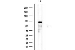 Western blot analysis of lysates from EC304 cells, using Cytokeratin 16 Mouse Monoclonal Antibody at 1/1000 dilution.
