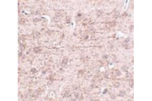 Immunohistochemistry of ZBTB1 in mouse brain tissue with this product at 2.