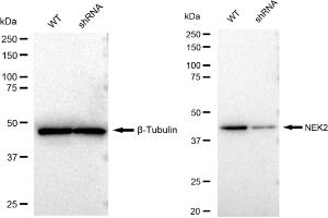 anti-NIMA (Never in Mitosis Gene A)-Related Kinase 2 (NEK2) antibody