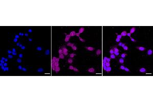 Immunocytochemical staining of HAP-1 cells with Phospho-c-Myc (T58) antibody (ABIN7799504), 1:1,000). (Recombinant c-MYC anticorps  (pThr58))