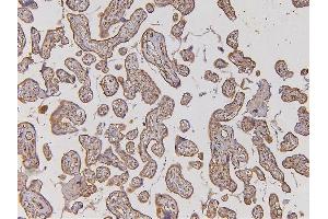 IHC analysis of EHD1 using anti-EHD1 antibody (ABIN6719599). (EHD1 anticorps  (AA 324-516))