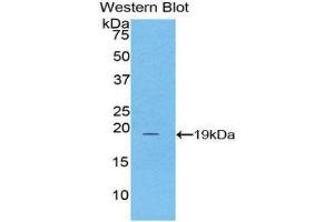 Western Blotting (WB) image for anti-Adrenoceptor alpha 1A (ADRA1A) (AA 330-466) antibody (ABIN1857926) (alpha 1 Adrenergic Receptor anticorps  (AA 330-466))