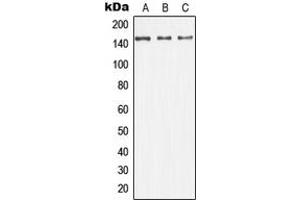 Western blot analysis of ASK1 expression in HeLa (A), SP2/0 (B), H9C2 (C) whole cell lysates.
