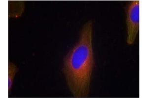Image no. 2 for anti-Synaptotagmin I (SYT1) (Thr199), (Thr202) antibody (ABIN319341)