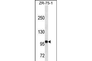 FUT4 Antibody (ABIN1539891 and ABIN2843850) western blot analysis in ZR-75-1 cell line lysates (35 μg/lane). (CD15 anticorps  (AA 425-454))