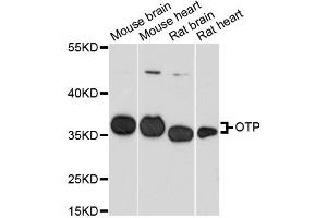 Western blot analysis of extracts of various cell lines, using OTP antibody. (OTP anticorps)