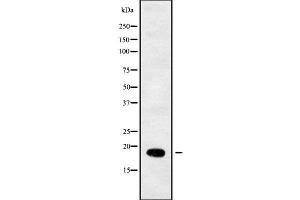 Western blot analysis of RPL29 using COLO205 whole cell lysates (RPL29 anticorps  (Internal Region))