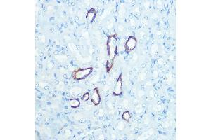 Immunohistochemistry of paraffin-embedded mouse kidney using Aquaporin-4 (Aquaporin-4 ) Rabbit mAb (ABIN7265653) at dilution of 1:100 (40x lens).