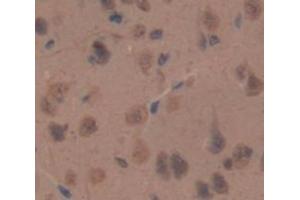 IHC-P analysis of Rat Tissue, with DAB staining. (NPPC anticorps  (AA 31-126))