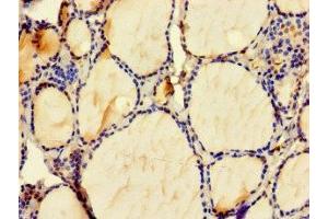 Immunohistochemistry of paraffin-embedded human thyroid tissue using ABIN7176080 at dilution of 1:100