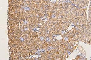 IHC analysis of SFRP1 using anti-SFRP1 antibody (ABIN6719484). (SFRP1 anticorps)