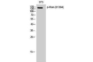 Western Blotting (WB) image for anti-Macrophage Stimulating 1 Receptor (C-Met-Related tyrosine Kinase) (MST1R) (pSer1394) antibody (ABIN3173035) (MST1R anticorps  (pSer1394))