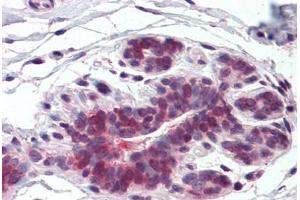 Anti-ELOVL5 antibody  ABIN960769 IHC staining of human breast. (ELOVL5 anticorps  (Internal Region))