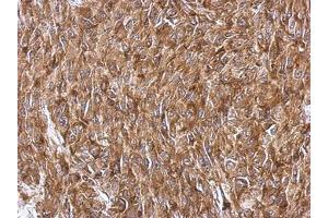 Image no. 2 for anti-Ribosomal Protein S3A (RPS3A) (AA 1-264) antibody (ABIN1501993) (RPS3A anticorps  (AA 1-264))