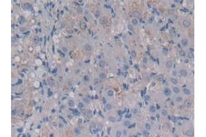 Detection of MCSF in Mouse Ovary Tissue using Polyclonal Antibody to Colony Stimulating Factor 1, Macrophage (MCSF) (M-CSF/CSF1 anticorps  (AA 33-204))