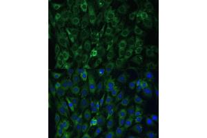 Immunofluorescence analysis of C6 cells using EIF3D antibody (ABIN6130833, ABIN6140057, ABIN6140058 and ABIN6221638) at dilution of 1:100.