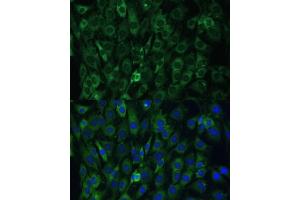 Immunofluorescence analysis of C6 cells using EIF3D antibody (ABIN6130833, ABIN6140057, ABIN6140058 and ABIN6221638) at dilution of 1:100. (EIF3D anticorps  (AA 1-240))