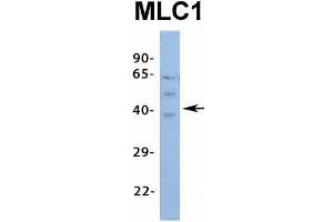 Host:  Rabbit  Target Name:  MLC1  Sample Type:  Human Fetal Spleen  Antibody Dilution:  1. (MLC1 anticorps  (Middle Region))
