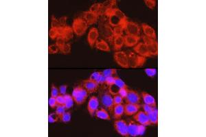 Immunofluorescence analysis of HepG2 cells using PYGL Rabbit pAb (ABIN6132277, ABIN6146525, ABIN6146526 and ABIN6222425) at dilution of 1:150 (40x lens). (PYGL anticorps  (AA 1-280))