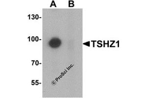 Western Blotting (WB) image for anti-Teashirt Zinc Finger Homeobox 1 (TSHZ1) (N-Term) antibody (ABIN1031647) (TSHZ1 anticorps  (N-Term))