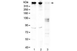 Western blot testing of 1) rat brain, 2) mouse brain and 3) human HeLa lysate with Sacsin antibody at 0. (Sacsin anticorps)