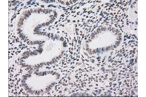 Image no. 1 for anti-TYRO3 Protein Tyrosine Kinase (TYRO3) antibody (ABIN1501607)