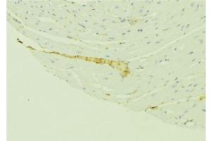 ABIN6276410 at 1/100 staining Mouse liver tissue by IHC-P. (VDAC1 anticorps  (C-Term))