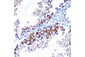 Immunohistochemistry of paraffin-embedded mouse testis using T Rabbit pAb (ABIN6130537, ABIN6143503, ABIN6143504 and ABIN6215581) at dilution of 1:100 (40x lens).
